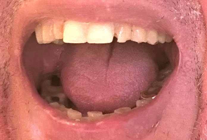 mund
